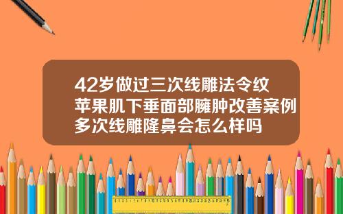 42岁做过三次线雕法令纹苹果肌下垂面部臃肿改善案例多次线雕隆鼻会怎么样吗