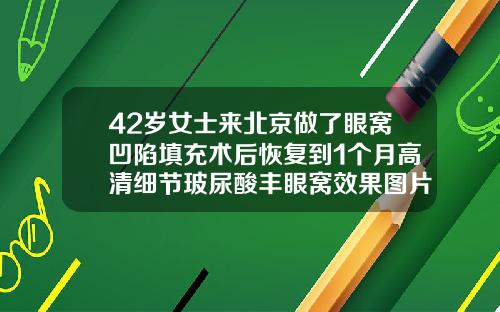 42岁女士来北京做了眼窝凹陷填充术后恢复到1个月高清细节玻尿酸丰眼窝效果图片