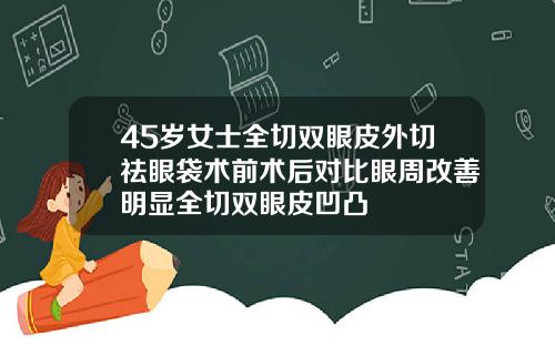 45岁女士全切双眼皮外切祛眼袋术前术后对比眼周改善明显全切双眼皮凹凸