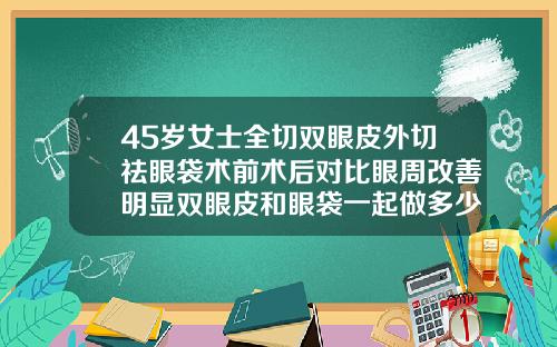 45岁女士全切双眼皮外切祛眼袋术前术后对比眼周改善明显双眼皮和眼袋一起做多少费用合适