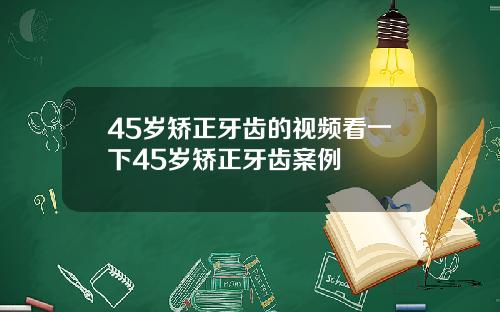45岁矫正牙齿的视频看一下45岁矫正牙齿案例