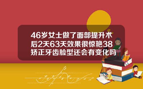 46岁女士做了面部提升术后2天63天效果很惊艳38矫正牙齿脸型还会有变化吗