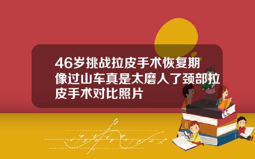 46岁挑战拉皮手术恢复期像过山车真是太磨人了颈部拉皮手术对比照片