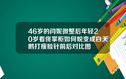 46岁的闫妮微整后年轻20岁看佟掌柜如何蜕变成白天鹅打瘦脸针前后对比图
