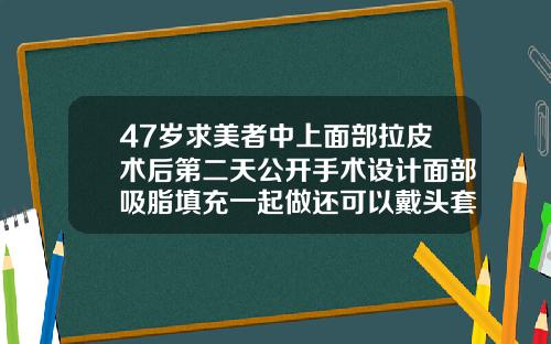 47岁求美者中上面部拉皮术后第二天公开手术设计面部吸脂填充一起做还可以戴头套吗