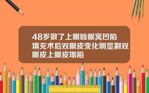 48岁做了上眼睑眼窝凹陷填充术后双眼皮变化明显割双眼皮上眼皮塌陷