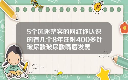 5个沉迷整容的网红你认识的有几个8年注射400多针玻尿酸玻尿酸嘴唇发黑
