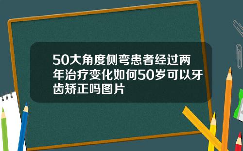50大角度侧弯患者经过两年治疗变化如何50岁可以牙齿矫正吗图片