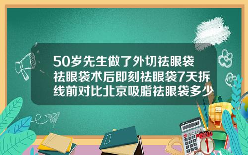50岁先生做了外切祛眼袋祛眼袋术后即刻祛眼袋7天拆线前对比北京吸脂祛眼袋多少钱