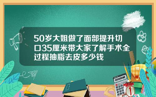 50岁大姐做了面部提升切口35厘米带大家了解手术全过程抽脂去皮多少钱