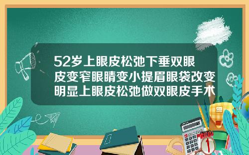 52岁上眼皮松弛下垂双眼皮变窄眼睛变小提眉眼袋改变明显上眼皮松弛做双眼皮手术