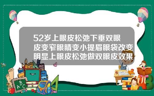 52岁上眼皮松弛下垂双眼皮变窄眼睛变小提眉眼袋改变明显上眼皮松弛做双眼皮效果好吗