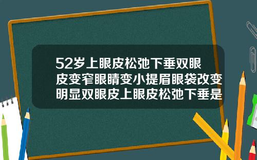 52岁上眼皮松弛下垂双眼皮变窄眼睛变小提眉眼袋改变明显双眼皮上眼皮松弛下垂是什么原因