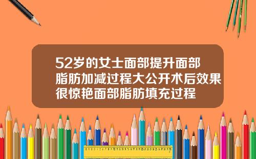 52岁的女士面部提升面部脂肪加减过程大公开术后效果很惊艳面部脂肪填充过程