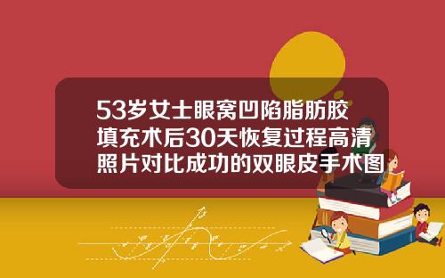 53岁女士眼窝凹陷脂肪胶填充术后30天恢复过程高清照片对比成功的双眼皮手术图片