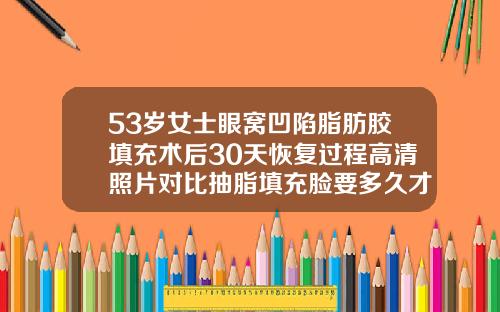 53岁女士眼窝凹陷脂肪胶填充术后30天恢复过程高清照片对比抽脂填充脸要多久才能恢复