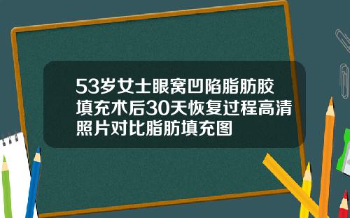 53岁女士眼窝凹陷脂肪胶填充术后30天恢复过程高清照片对比脂肪填充图