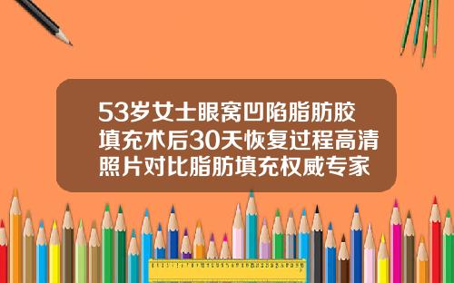 53岁女士眼窝凹陷脂肪胶填充术后30天恢复过程高清照片对比脂肪填充权威专家