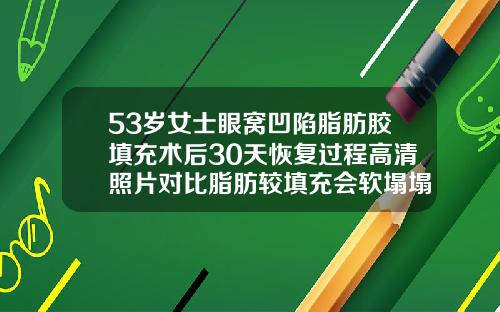 53岁女士眼窝凹陷脂肪胶填充术后30天恢复过程高清照片对比脂肪较填充会软塌塌的吗