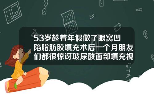 53岁趁着年假做了眼窝凹陷脂肪胶填充术后一个月朋友们都很惊讶玻尿酸面部填充视频