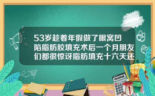 53岁趁着年假做了眼窝凹陷脂肪胶填充术后一个月朋友们都很惊讶脂肪填充十六天还没消肿
