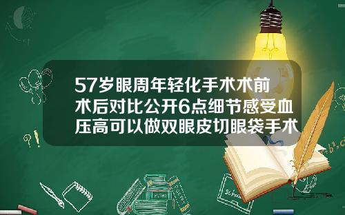 57岁眼周年轻化手术术前术后对比公开6点细节感受血压高可以做双眼皮切眼袋手术吗