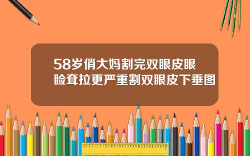 58岁俏大妈割完双眼皮眼睑耷拉更严重割双眼皮下垂图
