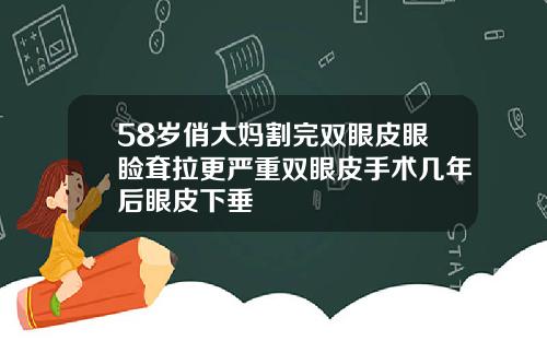 58岁俏大妈割完双眼皮眼睑耷拉更严重双眼皮手术几年后眼皮下垂