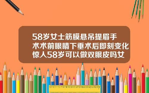58岁女士筋膜悬吊提眉手术术前眼睛下垂术后即刻变化惊人58岁可以做双眼皮吗女