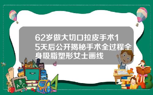 62岁做大切口拉皮手术15天后公开揭秘手术全过程全身吸脂塑形女士画线