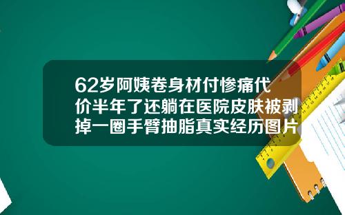 62岁阿姨卷身材付惨痛代价半年了还躺在医院皮肤被剥掉一圈手臂抽脂真实经历图片