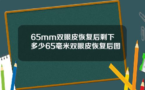 65mm双眼皮恢复后剩下多少65毫米双眼皮恢复后图
