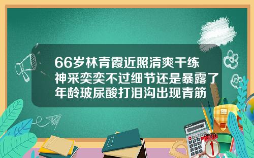 66岁林青霞近照清爽干练神采奕奕不过细节还是暴露了年龄玻尿酸打泪沟出现青筋